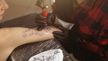 Retirer un Tatouage au Laser